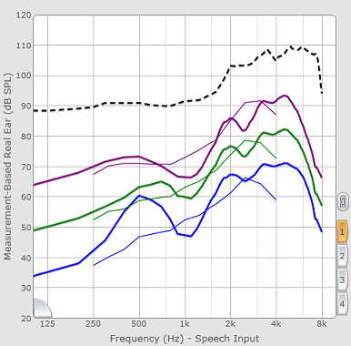 Measurement-Based Real Ear Response